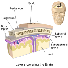 head1